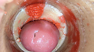 Camera Inside Deep Pussy Captures Big dose Ejaculation of Sperm ASMR