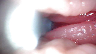 First time: An endoscope reveals the G-spot up close - without mountingl