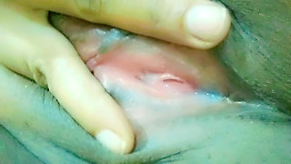 White pussy discharge