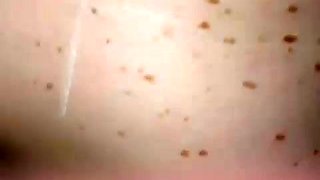 Worms Amateur Porn Porn Sex