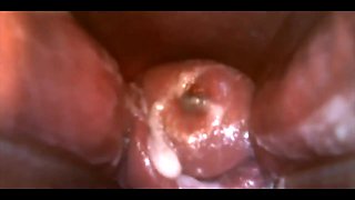 Play with Speculum and View Inside My Pussy by Inside Camera