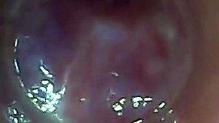 Endoscope POV: Test Tube Cock Urethral Insertion