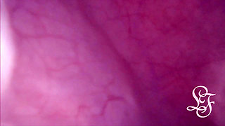 Fucked in my Pussy + Camera in my Bladder = Crazy Bulge! - Full Video on Fansly and Manyvids