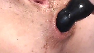 Anal Gaping and Prolapse Compilation!