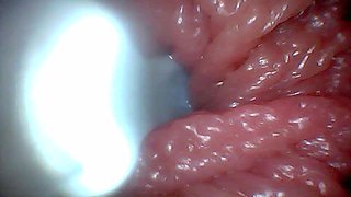 First Time: an Endoscope Reveals the G-spot up Close - Without Mounting!