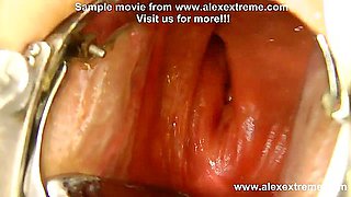 Extreme Anal Fisting, Huge Dildos And Prolapse Compilation From Alexextreme 30-46