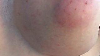 Massaging and Squeezing My Boobs After Reconstruction