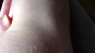 I Show You the Bruises on My Legs After Rough Sex