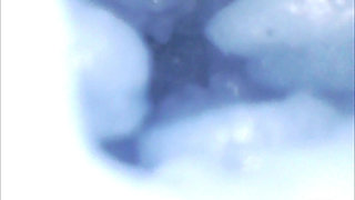Endoscope Lens Captures Unbearable Pleasure