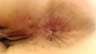 Extreme Asshole Hd Puckers