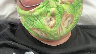 Welp, I Messed up My Foot