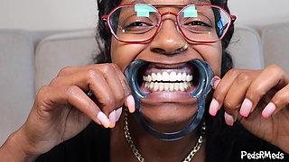Youronlyphoenix Dental Retractor Mouth Tour