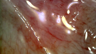 Medical Endoscope Oral Exam: Gummy Chewing, Extreme Teeth & Tongue Macro